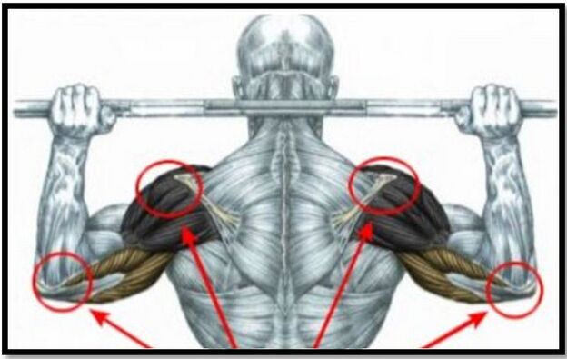 The strain on the shoulder and elbow muscles is one of the causes of osteoarthritis of the shoulder joint